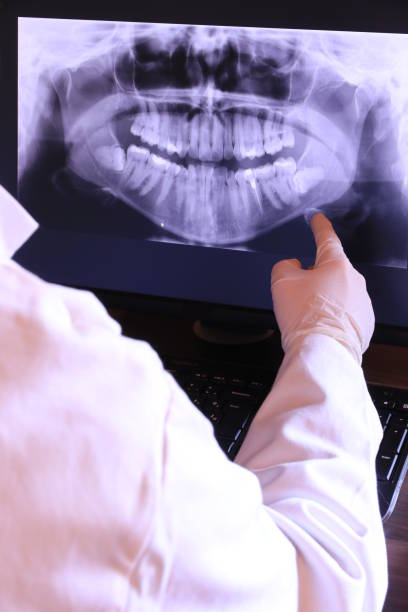 Best Weekend Emergency Dentist in Mount Pleasant, SC